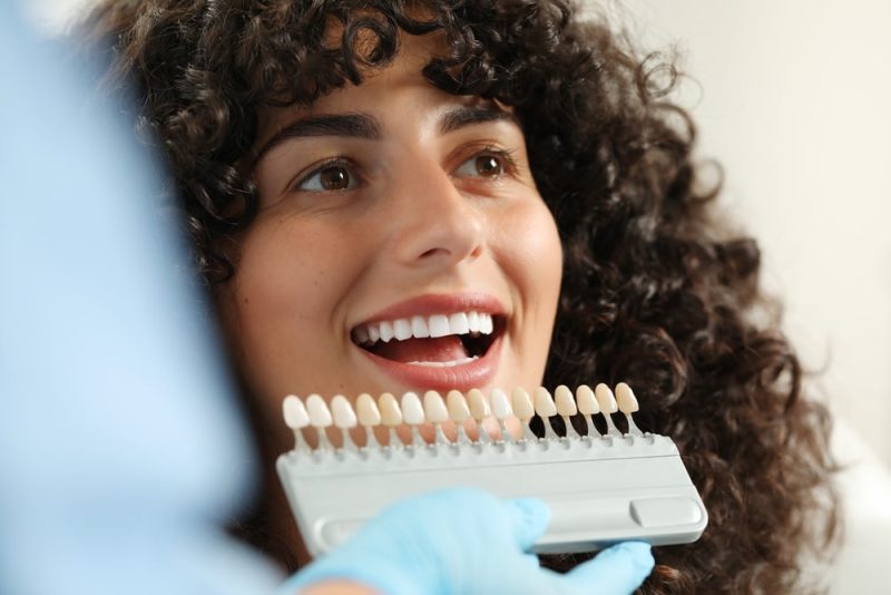 Veneers Allen