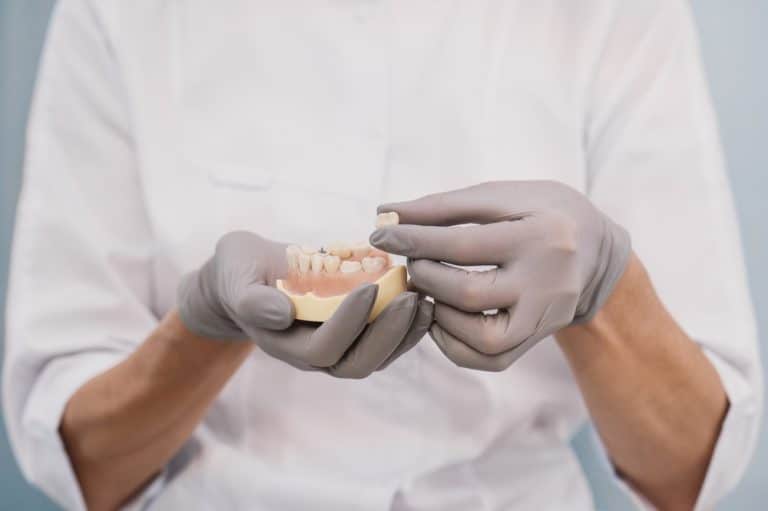 Dental Crowns Allen
